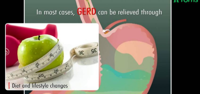 Gastro Esophageal Reflux Disease Causes, Symptoms & Treatment, Fortis Healthcare, Bangalore, India