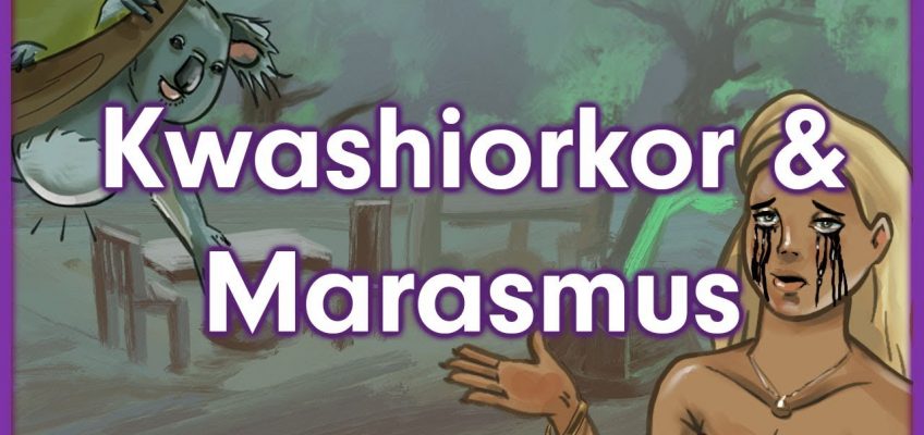 Kwashiorkor vs. Marasmus | Nutrition Mnemonic