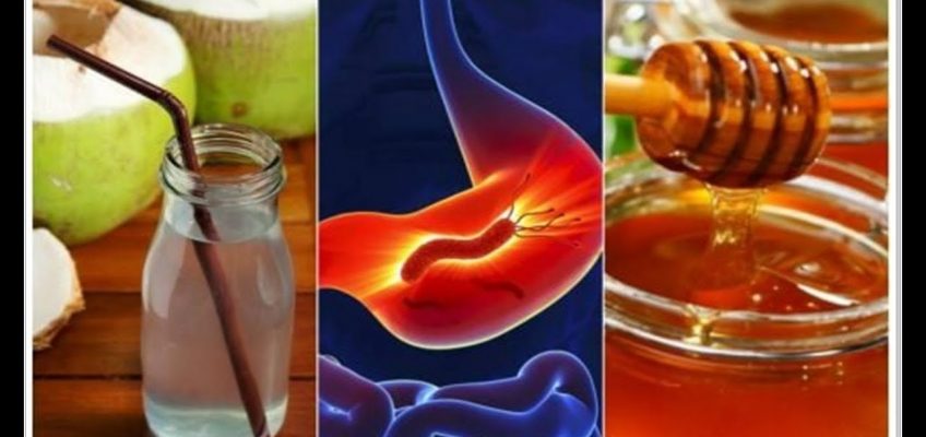 Gastritis Symptoms: Try These Natural Remedies for Gastritis