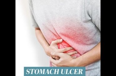 Stomach Ulcers │Home Remedies For Ulcers