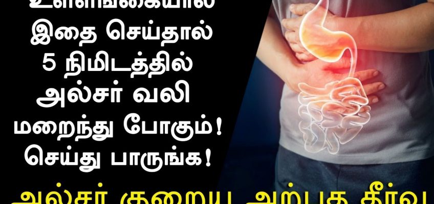 அல்சர் குணமாக வீட்டு வைத்தியம் – Ulcer Treatment in Tamil  Ulcer Symptoms in Tamil Tamil Health Tips
