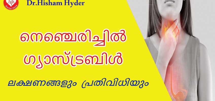 അസിഡിറ്റി, നെഞ്ചെരിച്ചിൽ, ഗ്യാസ് ട്രബിൾ| Gastritis Malayalam Tips | Acidity Home remedies
