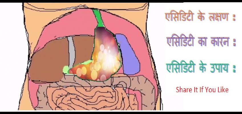Acidity in stomach and Acidity treatment in Hindi