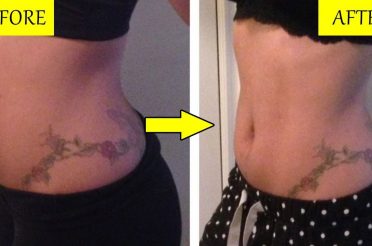 Effective Home Remedies To Get Rid Of Bloated Stomach