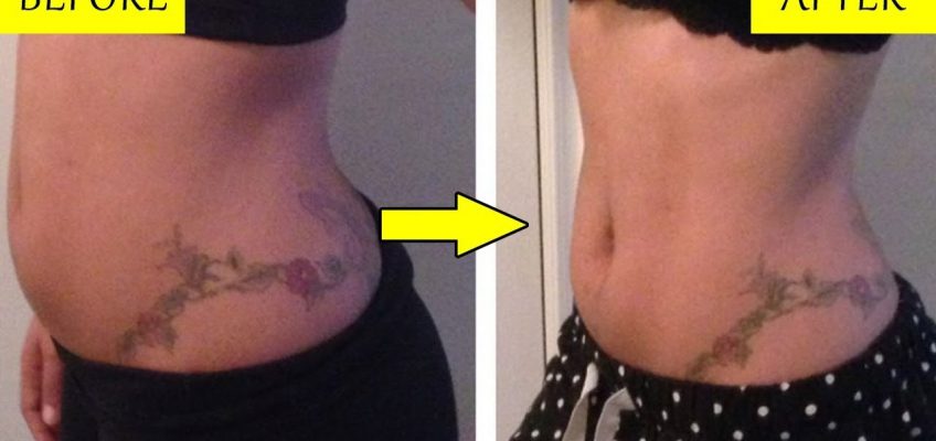 Effective Home Remedies To Get Rid Of Bloated Stomach