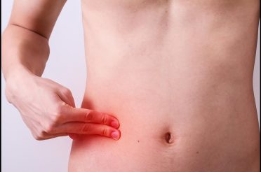 HOW TO PREVENT AND DEAL WITH APPENDICITIS NATURALLY