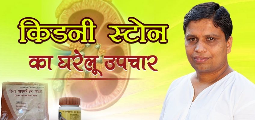 Home Remedies for Kidney Stones | Acharya Balkrishna