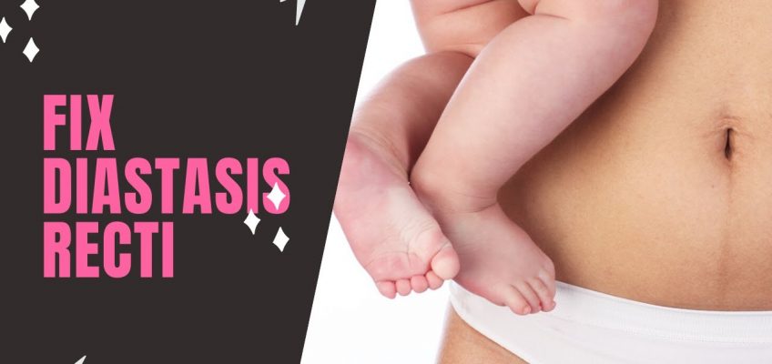 How to fix diastasis recti