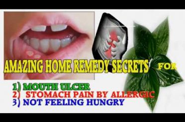 Mouth Ulcer Treatment at Home-Home Remedies