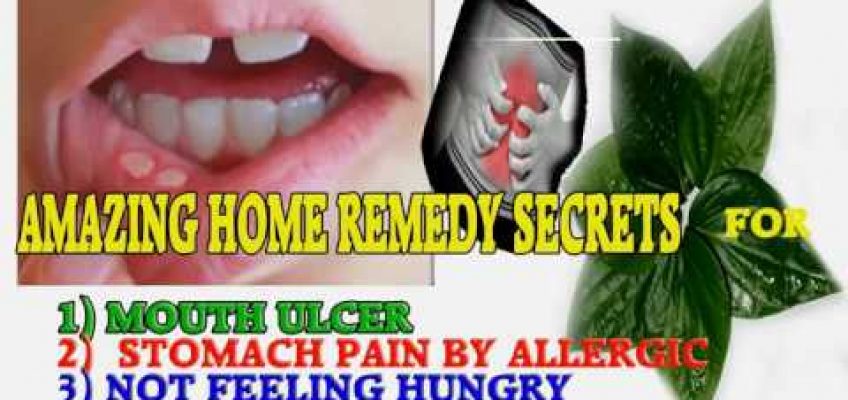 Mouth Ulcer Treatment at Home-Home Remedies
