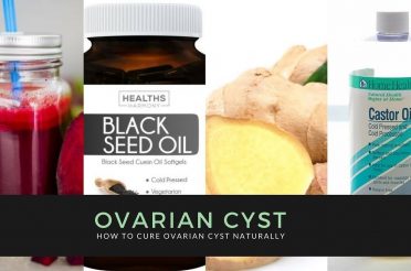 NATURAL REMEDIES FOR OVARIAN CYST