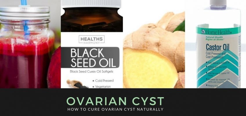 NATURAL REMEDIES FOR OVARIAN CYST