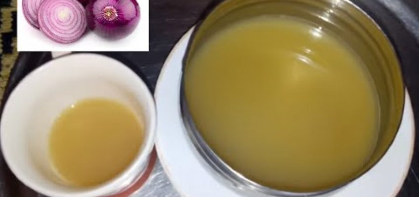 Onion Juice Medicine –  home remedies for small babies for stomach ache