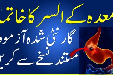 Stomach ulcer | Ulcer Home Remedy In Urdu | meday ke alsar ka ilaj