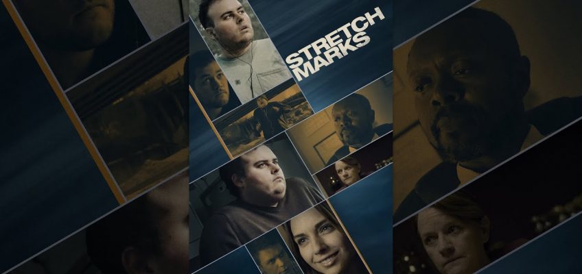 Stretch Marks