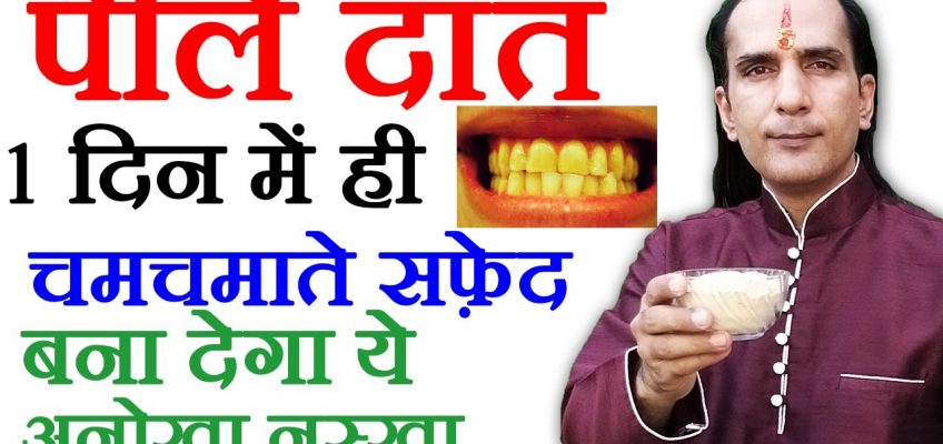 दांतों का पीलापन कैसे दूर करे-How To Cure Yellow teeth by Sachin Goyal-danto ka pilapan kaise hataye
