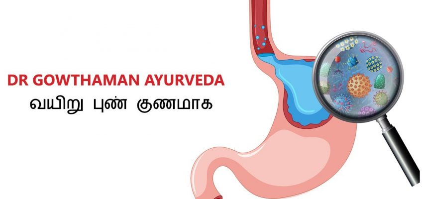 வயிறு புண் குணமாக | Remedy for Stomach Ulcer, Peptic Ulcer | Tamil Health Tips