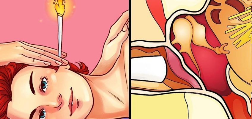 25 DIY HOME REMEDIES THAT MAY SAVE YOUR LIFE