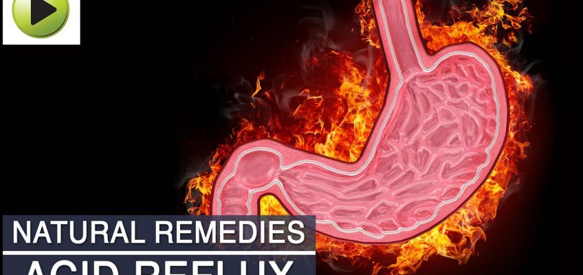 Acid Reflux (Acidity) – Natural Ayurvedic Home Remedies