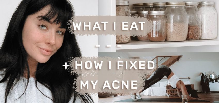Full Day of Healthy Eating | Curing Hormonal Acne Naturally