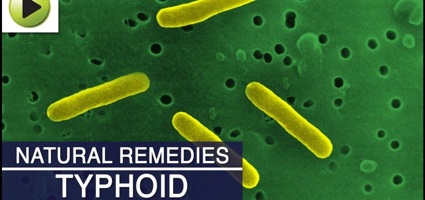 Home Remedies for Typhoid