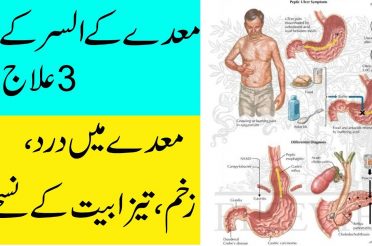 How To Cure Stomach Ulcer Home Remedies In Urdu/Hindi | Maday Ka Ilaj