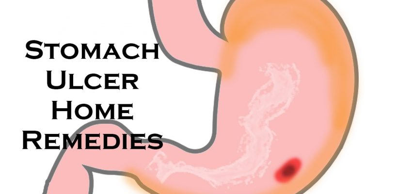 How To Cure Stomach Ulcer / Home Remedies for Stomach Ulcer @ ekunji