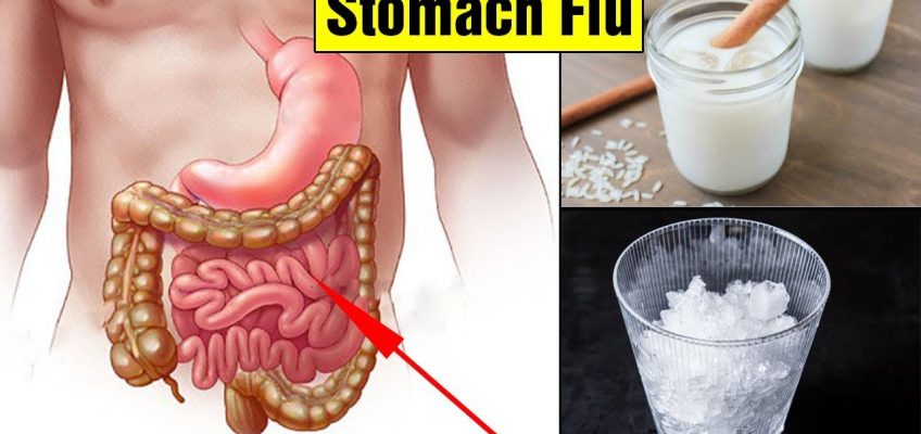 Top 14 Home Remedies for Stomach Flu|How TO Get Rid of Stomach Flu