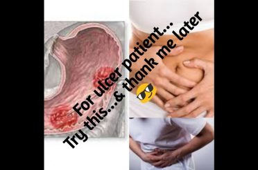 2 Best Home Remedies For Stomach Ulcer, Peptic Ulcer & Acid Reflux.