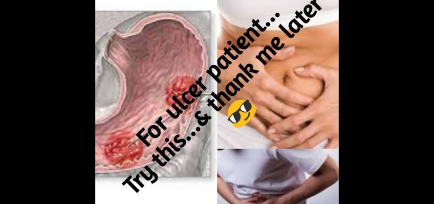 2 Best Home Remedies For Stomach Ulcer, Peptic Ulcer & Acid Reflux.