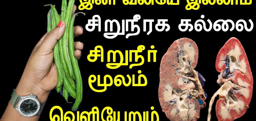 5 முருங்கை பீன்ஸ் போதும் வலியில்லாம சிறுநீர்க்கல் வெளியவரும் | kidney stones home remedy in tamil