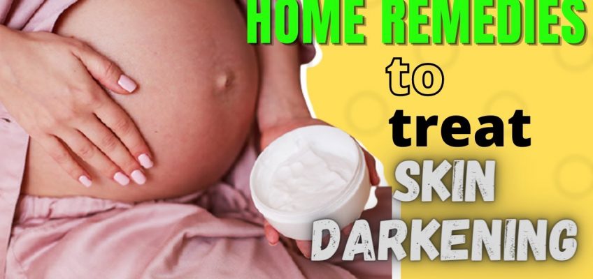 Home Remedies To Treat Skin Darkening During Pregnancy