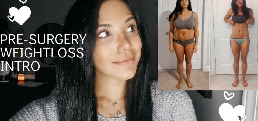 Pre-Surgery WEIGHTLOSS! Talking thru what nutrition plan I followed! #diet #weightloss #loseweight