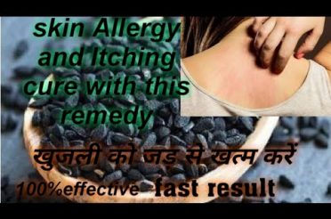 Skin Allergy and Itching/त्वचा रोग और खुजली/ Permanent solution with this home remedy