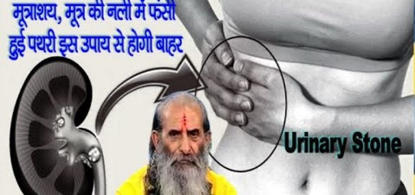 मूत्राशय की पथरी का 100% सफल ईलाज ||  Home Remedies for Kidney Stones ||