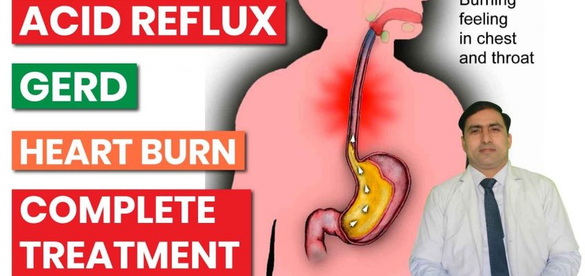 ACID REFLUX | GERD | HEART BURN | COMPLETE SOLUTION & DIET | in HINDI