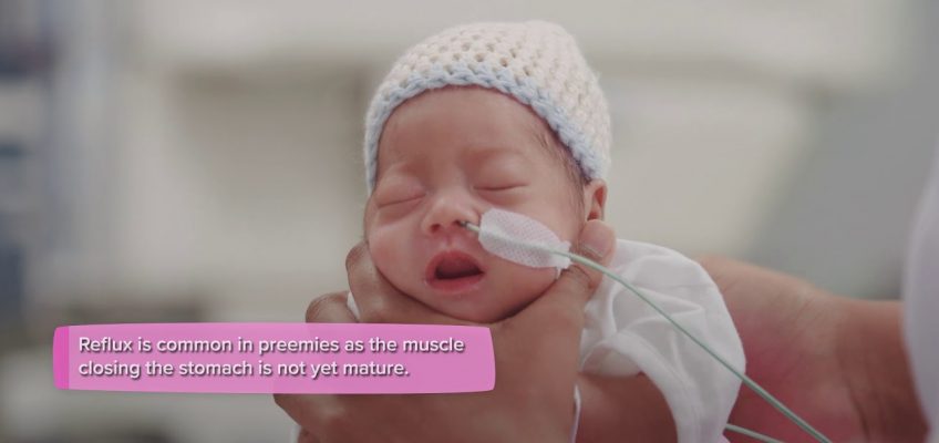 Premature baby – Nutrition and feeding